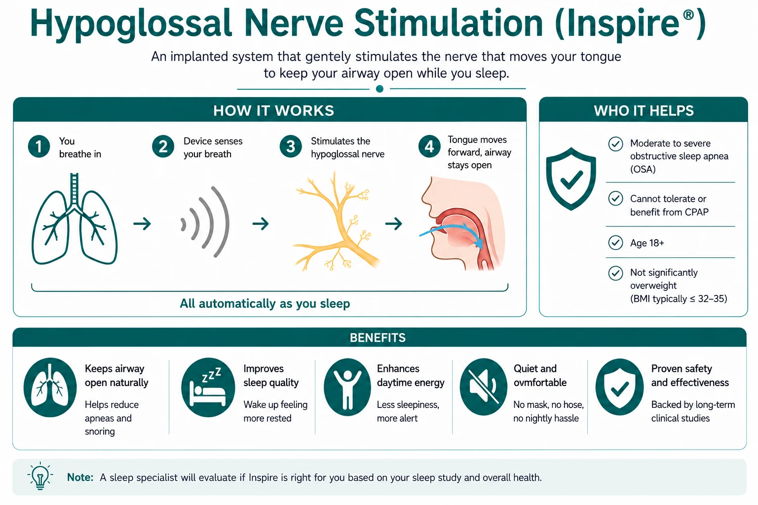 Hypoglossal nerve stimulation illustration showing how Inspire therapy senses breathing and stimulates the hypoglossal nerve to help keep the airway open during sleep.